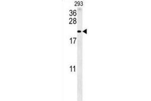 Western Blotting (WB) image for anti-Tachykinin, Precursor 1 (TAC1) antibody (ABIN3002474) (TAC1 抗体)