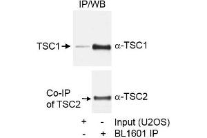 anti-Tuberous Sclerosis 1 (TSC1) (C-Term) antibody