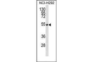 Western blot analysis using SFRS11 Antibody (C-term) Cat. (SRSF11 抗体  (C-Term))