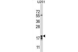Western Blotting (WB) image for anti-Cancer/testis Antigen 2 (CTAG2) antibody (ABIN2997526) (CTAG2 抗体)