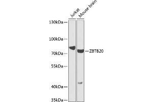 Western blot analysis of extracts of various cell lines, using ZBTB20 antibody (ABIN6130809, ABIN6150372, ABIN6150373 and ABIN6223978) at 1:1000 dilution. (ZBTB20 抗体  (AA 100-400))