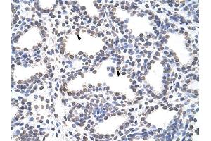 CARS antibody was used for immunohistochemistry at a concentration of 4-8 ug/ml to stain Alveolar cells (arrows) in Human Lung. (CARS 抗体  (C-Term))