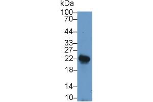 Detection of LIF in Rat Spleen lysate using Polyclonal Antibody to Leukemia Inhibitory Factor (LIF) (LIF 抗体  (AA 2-201))
