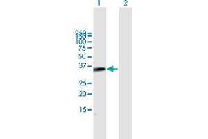 Western Blot analysis of C2 expression in transfected 293T cell line by C2 MaxPab polyclonal antibody. (Complement C2 抗体  (AA 20-328))