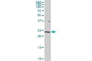GSTZ1 MaxPab rabbit polyclonal antibody. (GSTZ1 抗体  (AA 1-216))
