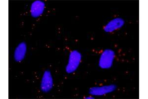 Proximity Ligation Analysis of protein-protein interactions between NFKBIB and FBXW11. (NFKBIB 抗体  (AA 1-356))