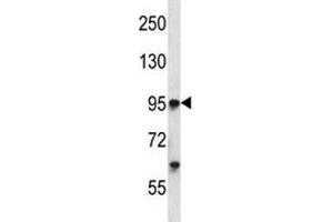 Tie1 antibody western blot analysis in K562 lysate. (TIE1 抗体  (AA 361-389))