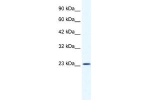 WB Suggested Anti-KCTD11 Antibody Titration:  1. (KCTD11 抗体  (N-Term))