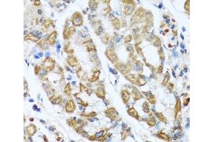 Immunohistochemistry of paraffin-embedded Human stomach using ANTXR2 Polyclonal Antibody at dilution of 1:100 (40x lens). (ANTXR2 抗体)