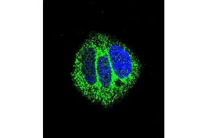 Confocal immunofluorescent analysis of RARA Antibody (C-term) (ABIN657770 and ABIN2846746) with MCF-7 cell followed by Alexa Fluor® 488-conjugated goat anti-rabbit lgG (green). (Retinoic Acid Receptor alpha 抗体  (C-Term))