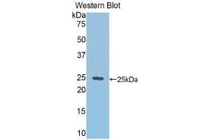 Western Blotting (WB) image for anti-RalA Binding Protein 1 (RALBP1) (AA 192-380) antibody (ABIN1860399) (RALBP1 抗体  (AA 192-380))