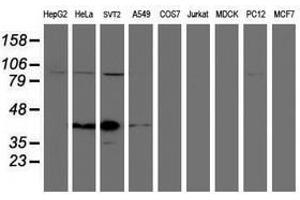 Image no. 1 for anti-Spastic Paraplegia 7 (SPG7) (AA 300-573) antibody (ABIN1491371) (SPG7 抗体  (AA 300-573))