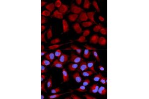 Immunofluorescence (IF) image for anti-Pyruvate Dehydrogenase (Lipoamide) alpha 1 (PDHA1) (AA 30-390) antibody (ABIN3023697)