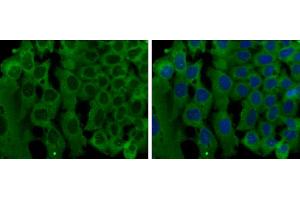 Immunofluorescence (IF) image for anti-Protein Tyrosine Phosphatase F Interacting Protein 1 (PPFIA1) (N-Term) antibody (ABIN2856986)