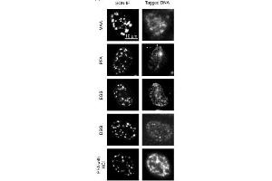 Images comparing the SON (a marker for nuclear speckles) immunofluorescence (IF) images (left panels) in different fixation conditions (MAA, methanol/acetic acid, 1% PFA; EGS, ethylene glycol bis(succinimidyl succinate); DSG, disuccinimidyl glutarate, 1% PFA followed by 0. (SON 抗体  (N-Term))