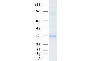FOS-Like Antigen 1 (FOSL1) protein (Myc-DYKDDDDK Tag)