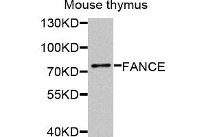Western blot analysis of extracts of mouse thymus, using FANCE antibody (ABIN5974901) at 1/1000 dilution. (FANCE 抗体)