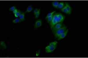Immunofluorescence staining of HepG2 cells with ABIN7171189 at 1:400, counter-stained with DAPI. (Syndecan 1 抗体  (AA 23-254))
