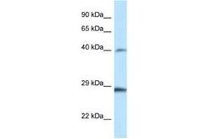 Image no. 1 for anti-Homeobox B9 (HOXB9) (AA 20-69) antibody (ABIN6747415) (HOXB9 抗体  (AA 20-69))