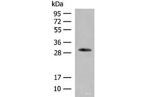 Western blot analysis of Human left thymus tissue lysate using VDAC3 Polyclonal Antibody at dilution of 1:200 (VDAC3 抗体)
