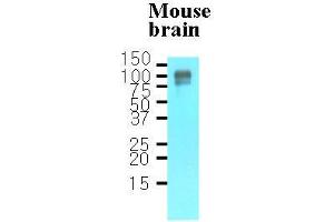 Tissue lysates of mouse brain(30 ug) were resolved by SDS-PAGE, transferred to nitrocellulose membrane and probed with anti-human APP (1:1000). (APP 抗体  (AA 18-289))