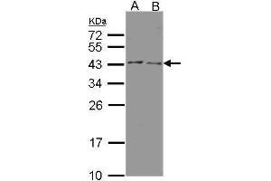 WB Image Sample(30 μg of whole cell lysate) A:HeLa S3 , B:MOLT4, 12% SDS PAGE antibody diluted at 1:500 (HSD3B2 抗体)