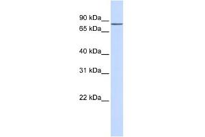 WB Suggested Anti-ZNF420 Antibody Titration:  0. (ZNF420 抗体  (N-Term))