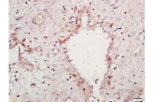 Formalin-fixed and paraffin embedded human placenta labeled with Anti-MAPK11 Polyclonal Antibody, Unconjugated (ABIN754393) at 1:200 followed by conjugation to the secondary antibody and DAB staining (MAPK11 抗体  (AA 21-120))