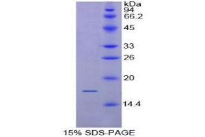 SDS-PAGE (SDS) image for CD72 Molecule (CD72) (AA 126-237) protein (His tag) (ABIN2124394)