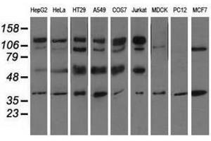Image no. 2 for anti-CD5 (CD5) antibody (ABIN1497337) (CD5 抗体)