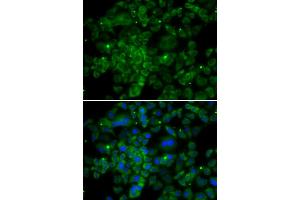 Immunofluorescence analysis of MCF-7 cells using CCL2 antibody (ABIN5974379). (CCL2 抗体)