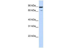 HIPK4 antibody used at 1 ug/ml to detect target protein. (HIPK4 抗体  (Middle Region))
