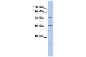 Western Blot showing COG5 antibody used at a concentration of 1-2 ug/ml to detect its target protein. (COG5 抗体  (N-Term))