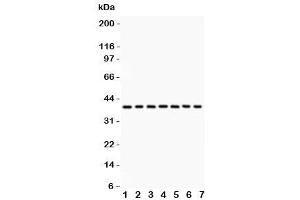 Western blot testing of Nucleophosmin antibody and Lane 1:  rat testis (NPM1 抗体  (AA 1-294))