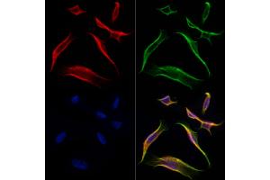 ABIN6261376 and ABIN6277015 staining Hela cells by IF/ICC. (Dystonin 抗体  (C-Term))