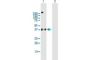 Western Blotting (WB) image for anti-Epithelial Cell Adhesion Molecule (EPCAM) (AA 1-314) antibody (ABIN517593)