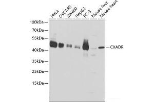 Western blot analysis of extracts of various cell lines using CXADR Polyclonal Antibody at dilution of 1:1000. (Coxsackie Adenovirus Receptor 抗体)