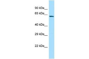 WB Suggested Anti-SOWAHC Antibody Titration: 1. (ANKRD57 抗体  (N-Term))