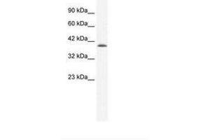 Image no. 2 for anti-Cation Channel, Sperm Associated 2 (CATSPER2) (AA 31-80) antibody (ABIN203121) (CATSPER2 抗体  (AA 31-80))