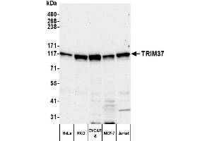 anti-Tripartite Motif Containing 37 (TRIM37) (AA 914-964) antibody