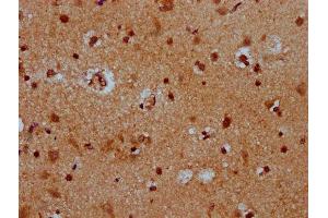 IHC image of ABIN7172561 diluted at 1:400 and staining in paraffin-embedded human brain tissue performed on a Leica BondTM system. (HES5 抗体  (AA 1-166))