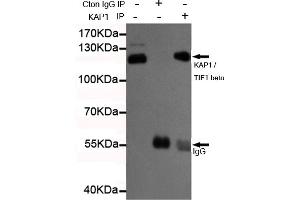 Immunoprecipitation analysis of Hela cell lysates using K / TIF1 beta mouse mAb.