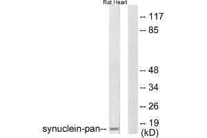 Western blot analysis of extracts from rat heart, using Synuclein-pan antibody (ABIN5976513). (Synuclein 抗体  (N-Term, pan))