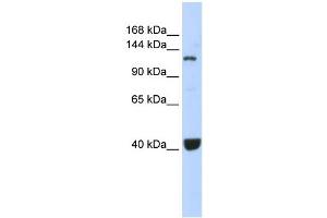 WB Suggested Anti-PIWIL1 Antibody Titration:  0. (PIWIL1 抗体  (Middle Region))
