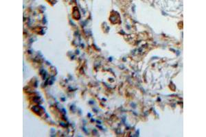 IHC-P analysis of lung tissue, with DAB staining. (HPSE 抗体  (AA 419-535))