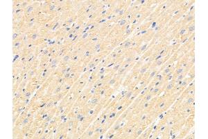 ABIN6265768 and ABIN6269034 at 1/100 staining Rat pancreatic tissue by IHC-P.