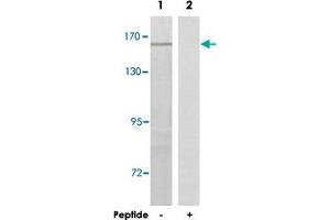 Western blot analysis of extracts from HeLa cells, using LGALS7B polyclonal antibody . (LGALS7B 抗体)