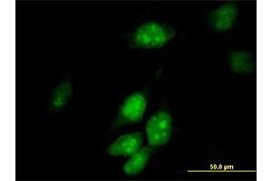 Immunofluorescence of purified MaxPab antibody to TRMT2A on HeLa cell. (TRMT2A 抗体  (AA 1-625))