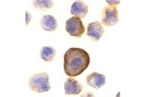 Immunohistochemistry (IHC) image for anti-TP53 Apoptosis Effector (PERP) (C-Term) antibody (ABIN1030575) (PERP 抗体  (C-Term))