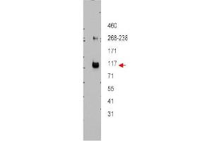 Image no. 1 for anti-ATP-Binding Cassette, Sub-Family B (MDR/TAP), Member 5 (ABCB5) (Internal Region) antibody (ABIN401433) (ABCB5 抗体  (Internal Region))